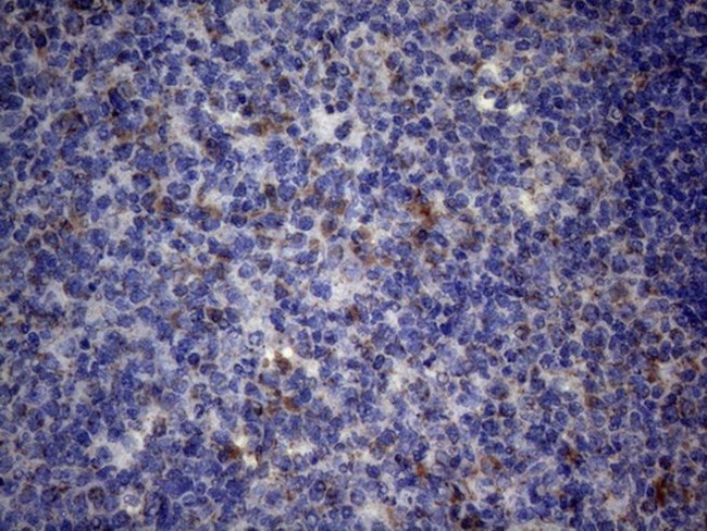 PPIF Antibody in Immunohistochemistry (Paraffin) (IHC (P))