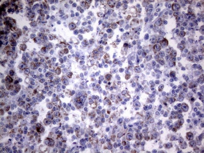 PPIF Antibody in Immunohistochemistry (Paraffin) (IHC (P))