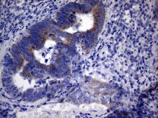 PPIF Antibody in Immunohistochemistry (Paraffin) (IHC (P))