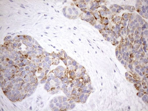 PPIF Antibody in Immunohistochemistry (Paraffin) (IHC (P))