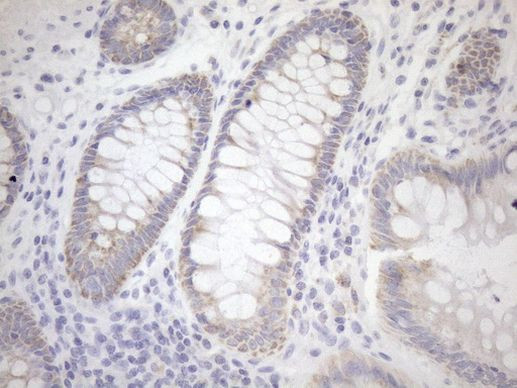 PPIF Antibody in Immunohistochemistry (Paraffin) (IHC (P))