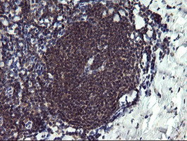 PPIL3 Antibody in Immunohistochemistry (Paraffin) (IHC (P))