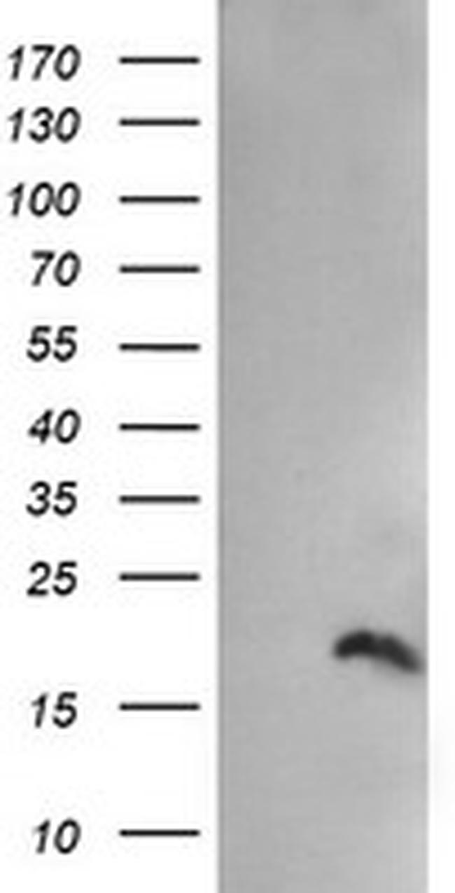 PPIL3 Antibody in Western Blot (WB)