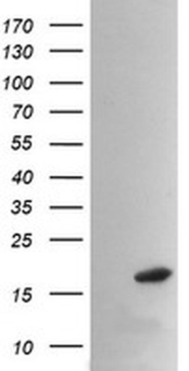 PPIL3 Antibody in Western Blot (WB)