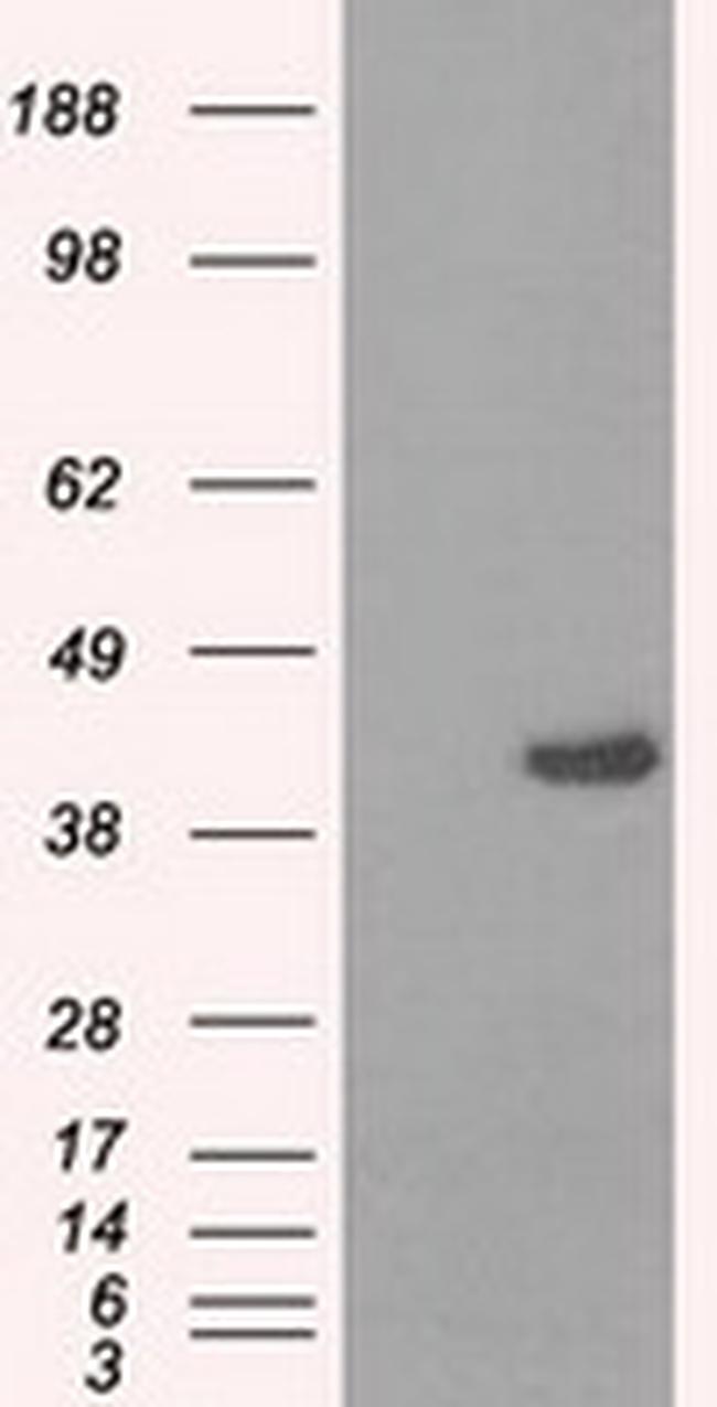 PPME1 Antibody in Western Blot (WB)