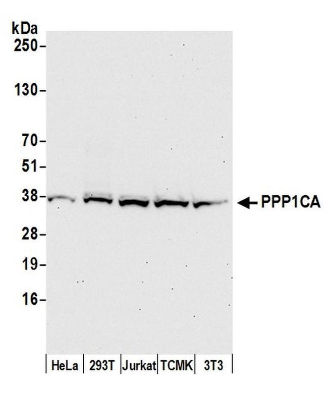 PPP1CA Antibody in Western Blot (WB)
