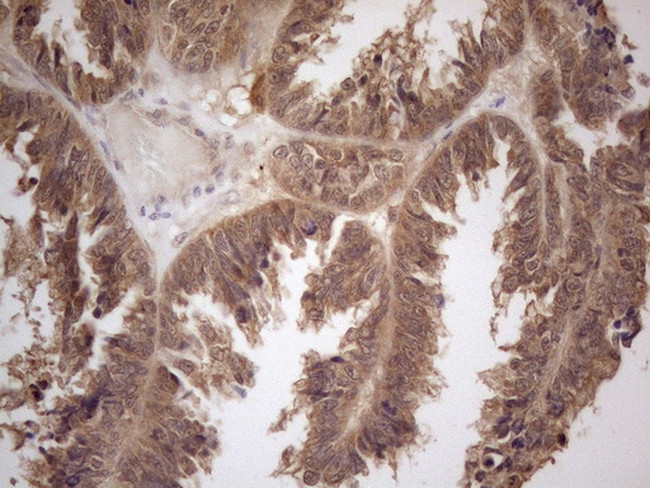 PPP1CA Antibody in Immunohistochemistry (Paraffin) (IHC (P))