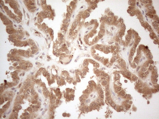 PPP1CA Antibody in Immunohistochemistry (Paraffin) (IHC (P))