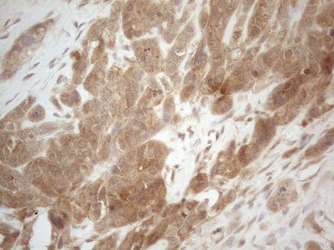 PPP1CA Antibody in Immunohistochemistry (Paraffin) (IHC (P))