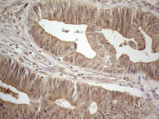 PPP1CA Antibody in Immunohistochemistry (Paraffin) (IHC (P))