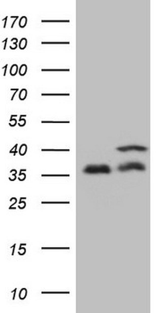 PPP1CA Antibody in Western Blot (WB)