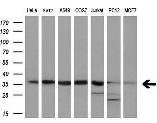 PPP1CA Antibody in Western Blot (WB)