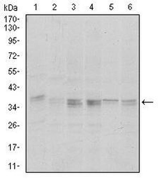 PP1 alpha Antibody in Western Blot (WB)