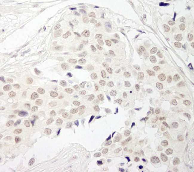 PPP1CB Antibody in Immunohistochemistry (IHC)