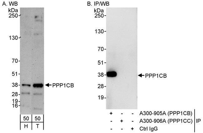 PPP1CB Antibody in Western Blot (WB)