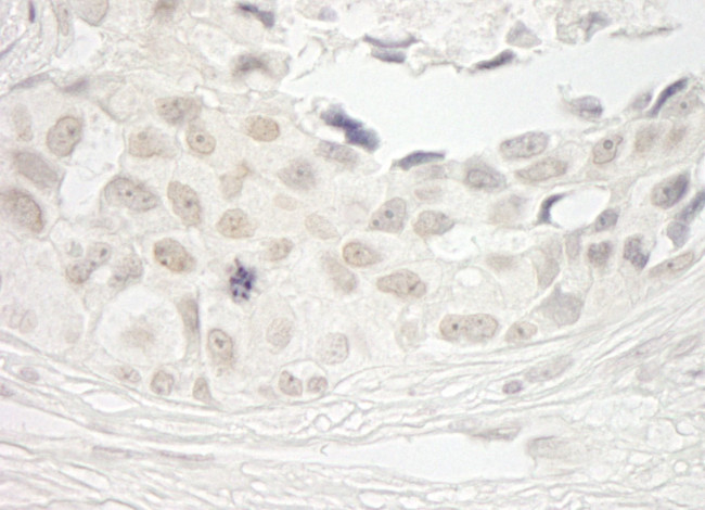 PPP1CB Antibody in Immunohistochemistry (IHC)