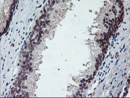 PPP1R15A Antibody in Immunohistochemistry (Paraffin) (IHC (P))