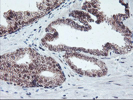 PPP1R15A Antibody in Immunohistochemistry (Paraffin) (IHC (P))