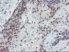 PPP1R15A Antibody in Immunohistochemistry (Paraffin) (IHC (P))