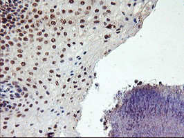 PPP1R15A Antibody in Immunohistochemistry (Paraffin) (IHC (P))