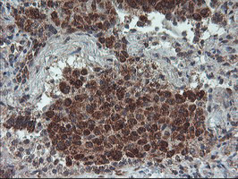 PPP1R15A Antibody in Immunohistochemistry (Paraffin) (IHC (P))