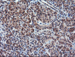 PPP1R15A Antibody in Immunohistochemistry (Paraffin) (IHC (P))