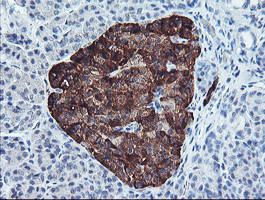 PPP1R15A Antibody in Immunohistochemistry (Paraffin) (IHC (P))