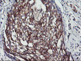 PPP1R15A Antibody in Immunohistochemistry (Paraffin) (IHC (P))