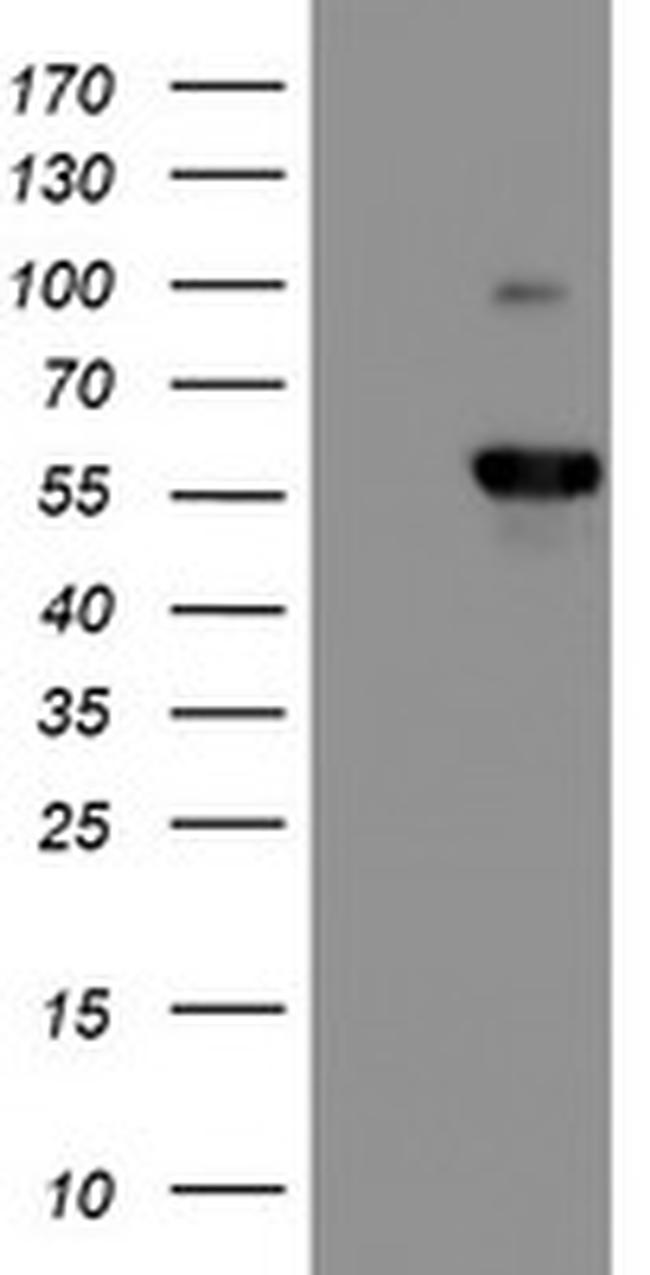 PPP1R15A Antibody in Western Blot (WB)