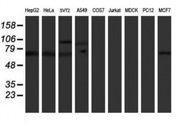 PPP1R15A Antibody in Western Blot (WB)