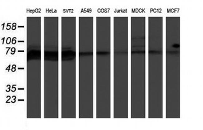 PPP1R15A Antibody in Western Blot (WB)