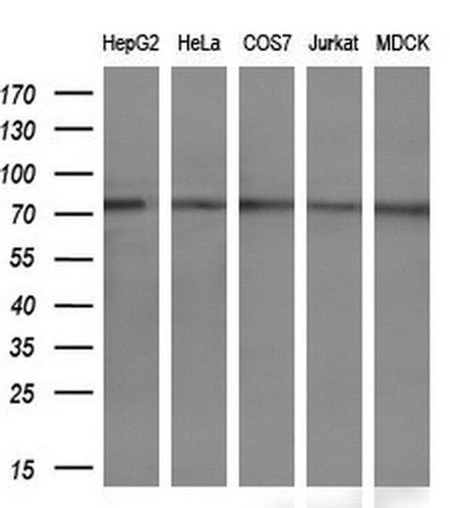 PPP1R15A Antibody in Western Blot (WB)