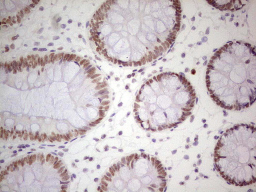 PPP1R8 Antibody in Immunohistochemistry (Paraffin) (IHC (P))