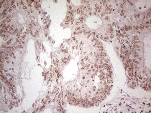 PPP1R8 Antibody in Immunohistochemistry (Paraffin) (IHC (P))