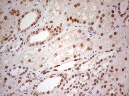 PPP1R8 Antibody in Immunohistochemistry (Paraffin) (IHC (P))