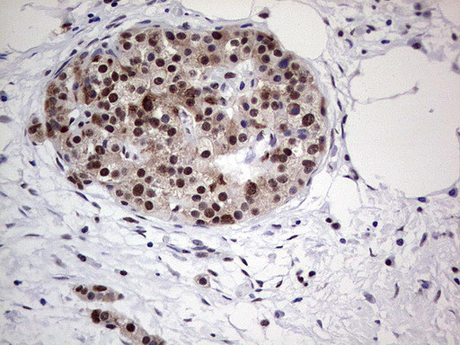 PPP1R8 Antibody in Immunohistochemistry (Paraffin) (IHC (P))