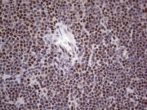 PPP1R8 Antibody in Immunohistochemistry (Paraffin) (IHC (P))