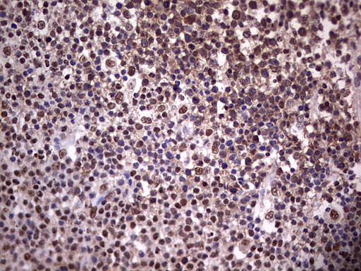 PPP1R8 Antibody in Immunohistochemistry (Paraffin) (IHC (P))