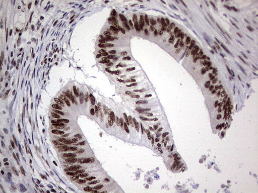 PPP1R8 Antibody in Immunohistochemistry (Paraffin) (IHC (P))