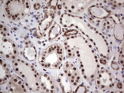 PPP1R8 Antibody in Immunohistochemistry (Paraffin) (IHC (P))