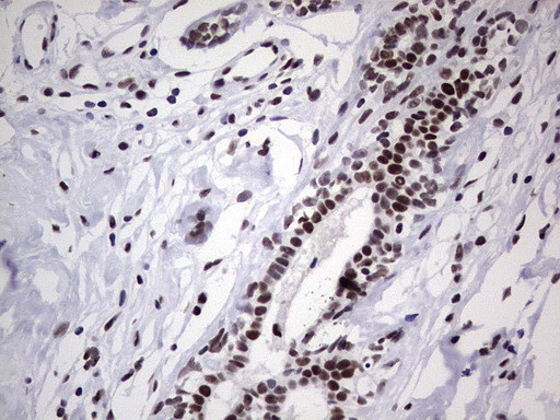 PPP1R8 Antibody in Immunohistochemistry (Paraffin) (IHC (P))