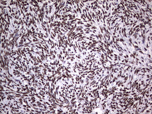 PPP1R8 Antibody in Immunohistochemistry (Paraffin) (IHC (P))