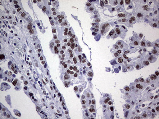 PPP1R8 Antibody in Immunohistochemistry (Paraffin) (IHC (P))