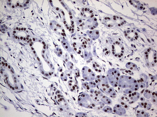 PPP1R8 Antibody in Immunohistochemistry (Paraffin) (IHC (P))