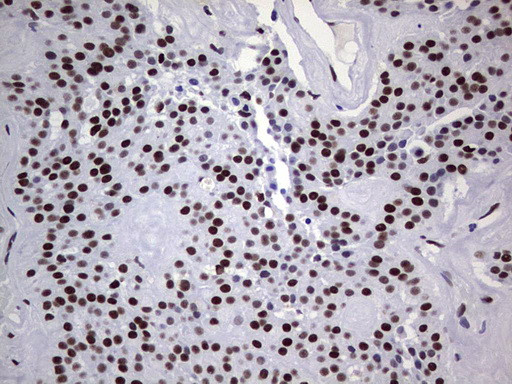 PPP1R8 Antibody in Immunohistochemistry (Paraffin) (IHC (P))