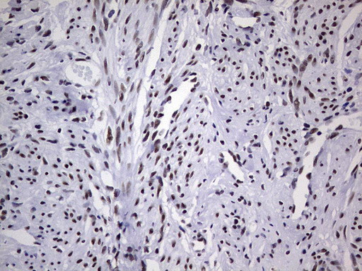 PPP1R8 Antibody in Immunohistochemistry (Paraffin) (IHC (P))