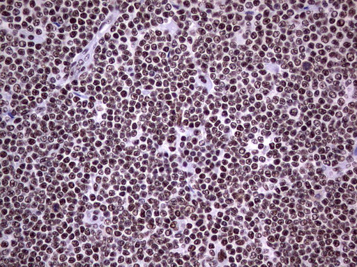 PPP1R8 Antibody in Immunohistochemistry (Paraffin) (IHC (P))