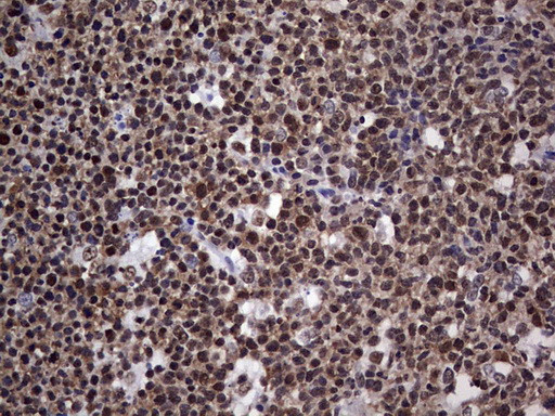 PPP1R8 Antibody in Immunohistochemistry (Paraffin) (IHC (P))