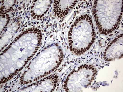 PPP1R8 Antibody in Immunohistochemistry (Paraffin) (IHC (P))