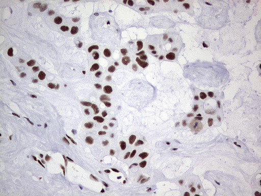 PPP1R8 Antibody in Immunohistochemistry (Paraffin) (IHC (P))